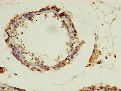 Immunohistochemistry of paraffin-embedded human testis tissue using the antibody at dilution of 1:100Rabbit anti-Human POLR3A Polyclonal Antibody
