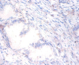 Immunohistochemistry of paraffin-embedded human prostate tissue using PON1 Antibody at dilution of 1:100Rabbit anti-Human PON1 Polyclonal Antibody