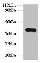Western blot  | All lanes: PON1 antibody at 2µg/ml + Mouse liver tissue  | Secondary  | Goat polyclonal to rabbit IgG at 1/10000 dilution  | Predicted band size: 40 kDa  | Observed band size: 40 kDaRabbit anti-Human PON1 Polyclonal Antibody