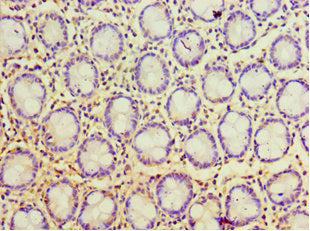 Immunohistochemistry of paraffin-embedded human colon tissue using POP7 Antibody at dilution of 1:100Rabbit anti-Human POP7 Polyclonal Antibody