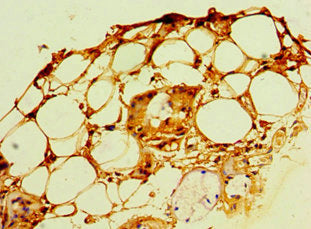 Immunohistochemistry of paraffin-embedded human trachea tissue using POP7 Antibody at dilution of 1:100Rabbit anti-Human POP7 Polyclonal Antibody