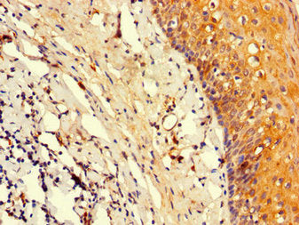 Immunohistochemistry of paraffin-embedded human tonsil tissue using POU2F2 Antibody at dilution of 1:100Rabbit anti-Human POU2F2 Polyclonal Antibody