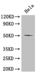 Western Blot  | Positive WB detected in: Hela whole cell lysate  | All lanes: POU2F2 antibody at 2µg/ml  | Secondary  | Goat polyclonal to rabbit IgG at 1/50000 dilution  | Predicted band size: 52, 50, 44, 63 kDa  | Observed band size: 52 kDaRabbit anti-Human POU2F2 Polyclonal Antibody