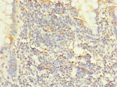 Immunohistochemistry of paraffin-embedded human small intestine tissue using PLPP2 Antibody at dilution of 1:100Rabbit anti-Human PLPP2 Polyclonal Antibody