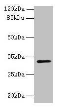 Western blot  | All lanes: PLPP2 antibody at 8µg/ml + MCF-7 whole cell lysate  | Secondary  | Goat polyclonal to rabbit IgG at 1/10000 dilution  | Predicted band size: 33, 35, 27 kDa  | Observed band size: 33 kDaRabbit anti-Human PLPP2 Polyclonal Antibody
