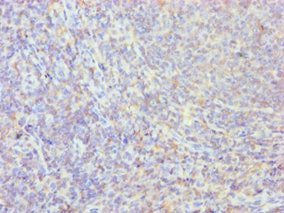 Immunohistochemistry of paraffin-embedded human tonsil tissue using PPIB Antibody at dilution of 1:100Rabbit anti-Human PPIB Polyclonal Antibody