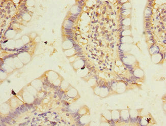 Immunohistochemistry of paraffin-embedded human small intestine tissue using PPM1D Antibody at dilution of 1:100Rabbit anti-Human PPM1D Polyclonal Antibody
