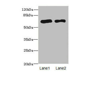 Western blot | All lanes: PPM1Dantibody at 2.36μg/ml | Lane 1: Rat gonadal tissue | Lane 2: U87 whole cell lysate | Secondary | Goat polyclonal to rabbit IgG at 1/10000 dilution | Predicted band size: 67, 48 kDa | Observed band size: 67 kDaRabbit anti-Human PPM1D Polyclonal Antibody