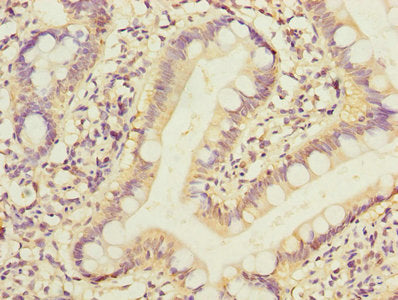 Immunohistochemistry of paraffin-embedded human small intestine tissue using PPM1D Antibody at dilution of 1:100Rabbit anti-Human PPM1D Polyclonal Antibody
