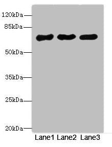 Western blot | All lanes: PPM1Dantibody at 2.66μg/ml | Lane 1: Rat gonadal tissue | Lane 2: U87 whole cell lysate | Lane 3: 293T whole cell lysate | Secondary | Goat polyclonal to rabbit IgG at 1/10000 dilution | Predicted band size: 67, 48 kDa | Observed band size: 67 kDaRabbit anti-Human PPM1D Polyclonal Antibody