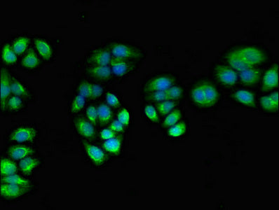 Immunofluorescent analysis of PC-3 cells using PPOX Antibody at dilution of 1:100 and Alexa Fluor 488-congugated AffiniPure Goat Anti-Rabbit IgG(H+L)Rabbit anti-Human PPOX Polyclonal Antibody
