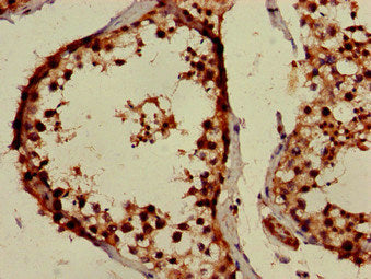 Immunohistochemistry of paraffin-embedded human testis tissue using PPOX Antibody at dilution of 1:100Rabbit anti-Human PPOX Polyclonal Antibody