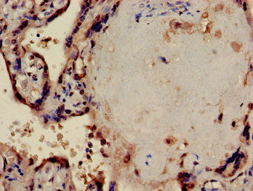 Immunohistochemistry of paraffin-embedded human placenta tissue using PPP1CA Antibody at dilution of 1:100Rabbit anti-Human PPP1CA Polyclonal Antibody