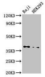 Western Blot  | Positive WB detected in: Raji whole cell lysate, HEK293 whole cell lysate  | All lanes: PPP1CB antibody at 3.5µg/ml  | Secondary  | Goat polyclonal to rabbit IgG at 1/50000 dilution  | Predicted band size: 38 kDa  | Observed band size: 38 kDaRabbit anti-Human PPP1CB Polyclonal Antibody