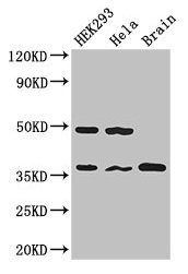 Western Blot  | Positive WB detected in: HEK293 whole cell lysate, Hela whole cell lysate, Mouse brain tissue  | All lanes: PPP1CC antibody at 2.7µg/ml  | Secondary  | Goat polyclonal to rabbit IgG at 1/50000 dilution  | Predicted band size: 37, 39 kDa  | Observed band size: 37 kDaRabbit anti-Human PPP1CC Polyclonal Antibody