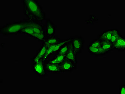 Immunofluorescent analysis of Hela cells using PPP2CA Antibody at dilution of 1:100 and Alexa Fluor 488-congugated AffiniPure Goat Anti-Rabbit IgG(H+L)Rabbit anti-Human PPP2CA Polyclonal Antibody