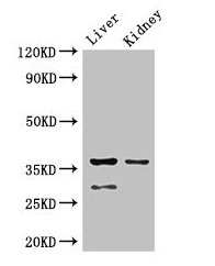 Western Blot | Positive WB detected in: Mouse liver tissue, Mouse kidney tissue | All lanes: PPP2CA antibody at 2.5μg/ml | Secondary | Goat polyclonal to rabbit IgG at 1/50000 dilution | Predicted band size: 36, 30 kDa | Observed band size: 36, 30 kDaRabbit anti-Human PPP2CA Polyclonal Antibody