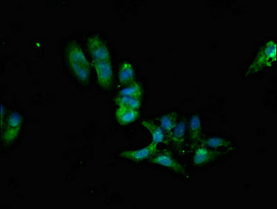 Immunofluorescent analysis of Hela cells using PPP2R2A Antibody at dilution of 1:100 and Alexa Fluor 488-congugated AffiniPure Goat Anti-Rabbit IgG(H+L)Rabbit anti-Human PPP2R2A Polyclonal Antibody