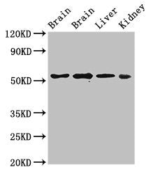 Western Blot | Positive WB detected in: Rat brain tissue, Mouse brain tissue, Mouse liver tissue, Mouse kidney tissue | All lanes: PPP2R2A antibody at 3μg/ml | Secondary | Goat polyclonal to rabbit IgG at 1/50000 dilution | Predicted band size: 52, 53 kDa | Observed band size: 52 kDaRabbit anti-Human PPP2R2A Polyclonal Antibody