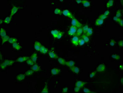 Immunofluorescence staining of SH-SY5Y cells with PPP2R2B Antibody at 1:200, counter-stained with DAPI. The cells were fixed in 4% formaldehyde, permeabilized using 0.2% Triton X-100 and blocked in 10% normal Goat Serum. The cells were then incubated with the antibody overnight at 4°C. The secondary antibody was Alexa Fluor 488-congugated AffiniPure Goat Anti-Rabbit IgG(H+L).Rabbit anti-Human PPP2R2B Polyclonal Antibody