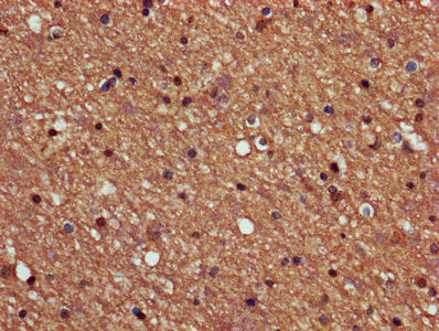 IHC image of the antibody diluted at 1:600 and staining in paraffin-embedded human brain tissue performed on a Leica BondTM system. After dewaxing and hydration, antigen retrieval was mediated by high pressure in a citrate buffer (pH 6.0). Section was blocked with 10% normal goat serum 30min at RT. Then primary antibody (1% BSA) was incubated at 4°C overnight. The primary is detected by a biotinylated secondary antibody and visualized using an HRP conjugated SP system.Rabbit anti-Human PPP2R2B Polyclonal Antibody