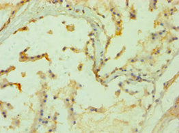 Immunohistochemistry of paraffin-embedded human prostate tissue using PPP3CC Antibody at dilution of 1:100Rabbit anti-Human PPP3CC Polyclonal Antibody