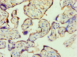 Immunohistochemistry of paraffin-embedded human placenta tissue using PPP3CC Antibody at dilution of 1:100Rabbit anti-Human PPP3CC Polyclonal Antibody