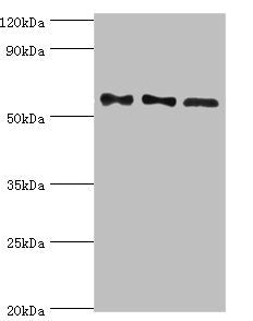 Western blot | All lanes: Serine/threonine-protein phosphatase 2B catalytic subunit gamma isoform antibody at 10μg/ml | Lane 1: Rat brain tissue | Lane 2: MCF-7 whole cell lysate | Lane 3: Rat skeletal muscle tissue | Secondary | Goat polyclonal to rabbit IgG at 1/10000 dilution | Predicted band size: 59, 58, 60 kDa | Observed band size: 59 kDaRabbit anti-Human PPP3CC Polyclonal Antibody