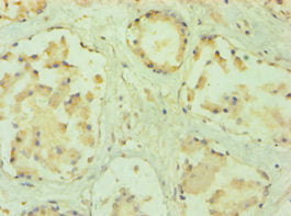 Immunohistochemistry of paraffin-embedded human prostate tissue using PPP3CC Antibody at dilution of 1:100Rabbit anti-Human PPP3CC Polyclonal Antibody