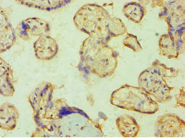 Immunohistochemistry of paraffin-embedded human placenta tissue using PPP3CC Antibody at dilution of 1:100Rabbit anti-Human PPP3CC Polyclonal Antibody