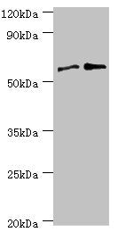 Western blot | All lanes: Serine/threonine-protein phosphatase 2B catalytic subunit gamma isoform antibody at 8μg/ml | Lane 1: Rat brain tissue | Lane 2: MCF-7 whole cell lysate | Secondary | Goat polyclonal to rabbit IgG at 1/10000 dilution | Predicted band size: 59, 58, 60 kDa | Observed band size: 59 kDaRabbit anti-Human PPP3CC Polyclonal Antibody