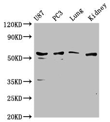 Western Blot | Positive WB detected in: U87 whole cell lysate, PC3 whole cell lysate, Mouse lung tissue, Mouse kidney tissue | All lanes: PPP5C antibody at 1:1000 | Secondary | Goat polyclonal to rabbit IgG at 1/50000 dilution | Predicted band size: 57 kDa | Observed band size: 57 kDaRabbit anti-Human PPP5C Polyclonal Antibody