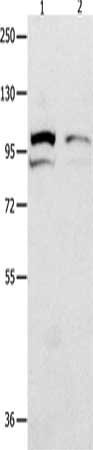 Gel: 8%SDS-PAGE, Lysate: 50 μg, Lane 1-2: 231 cells, mouse kidney tissue, Primary antibody: MVP Antibody(MVP Antibody) at dilution 1/500, Secondary antibody: Goat anti rabbit IgG at 1/8000 dilution, Exposure time: 1 secondRabbit anti-Human MVP Polyclonal Antibody