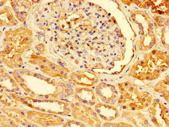 Immunohistochemistry of paraffin-embedded human kidney tissue using PRDX3 Antibody at dilution of 1:100Rabbit anti-Human PRDX3 Polyclonal Antibody