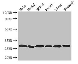 Western Blot  | Positive WB detected in: Hela whole cell lysate, HepG2 whole cell lysate, MCF-7 whole cell lysate, Mouse heart tissue, Mouse liver tissue, Mouse stomach tissue  | All lanes: PRDX3 antibody at 3.2μg/ml  | Secondary  | Goat polyclonal to rabbit IgG at 1/50000 dilution  | Predicted band size: 28, 26 kDa  | Observed band size: 28 kDaRabbit anti-Human PRDX3 Polyclonal Antibody