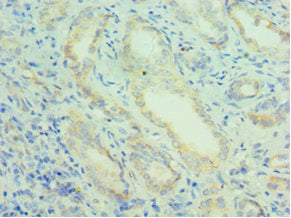 Immunohistochemistry of paraffin-embedded human kidney tissue using PRDX5 Antibody at dilution of 1:100Rabbit anti-Human PRDX5 Polyclonal Antibody