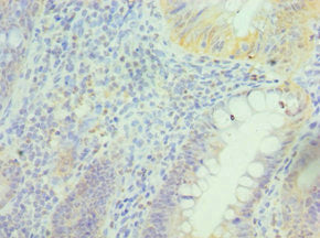Immunohistochemistry of paraffin-embedded human epityphlon tissue using PRDX5 Antibody at dilution of 1:100Rabbit anti-Human PRDX5 Polyclonal Antibody