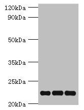 Western blot  | All lanes: PRDX5 antibody at 4µg/ml  | Lane 1: Mouse brain tissue  | Lane 2: Hela whole cell lysate  | Lane 3: 293T whole cell lysate  | Secondary  | Goat polyclonal to rabbit IgG at 1/10000 dilution  | Predicted band size: 23, 18, 13 kDa  | Observed band size: 23 kDaRabbit anti-Human PRDX5 Polyclonal Antibody