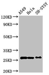 Western Blot | Positive WB detected in: A549 whole cell lysate, Hela whole cell lysate, SH-SY5Y whole cell lysate | All lanes: PRDX6 antibody at 4μg/ml | Secondary | Goat polyclonal to rabbit IgG at 1/50000 dilution | Predicted band size: 26 kDa | Observed band size: 26 kDaRabbit anti-Human PRDX6 Polyclonal Antibody