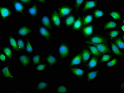Immunofluorescence staining of A549 cells with PREP Antibody at 1:50, counter-stained with DAPI. The cells were fixed in 4% formaldehyde, permeabilized using 0.2% Triton X-100 and blocked in 10% normal Goat Serum. The cells were then incubated with the antibody overnight at 4°C. The secondary antibody was Alexa Fluor 488-congugated AffiniPure Goat Anti-Rabbit IgG(H+L).Rabbit anti-Human PREP Polyclonal Antibody
