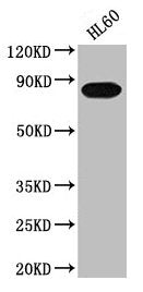 Western Blot  | Positive WB detected in: HL60 whole cell lysate  | All lanes: PREP antibody at 1:2000  | Secondary  | Goat polyclonal to rabbit IgG at 1/50000 dilution  | Predicted band size: 81 kDa  | Observed band size: 81 kDaRabbit anti-Human PREP Polyclonal Antibody