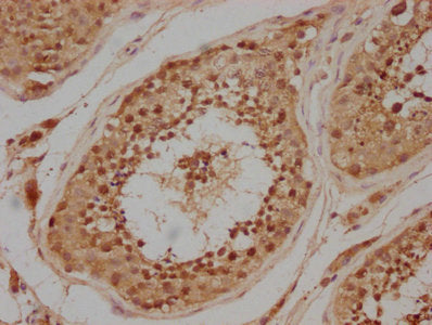 IHC image of PRKACA Antibody diluted at 1:200 and staining in paraffin-embedded human testis tissue performed on a Leica BondTM system. After dewaxing and hydration, antigen retrieval was mediated by high pressure in a citrate buffer (pH 6.0). Section was blocked with 10% normal goat serum 30min at RT. Then primary antibody (1% BSA) was incubated at 4°C overnight. The primary is detected by a biotinylated secondary antibody and visualized using an HRP conjugated SP system.Rabbit anti-Human PRKACA Polyclonal Antibody