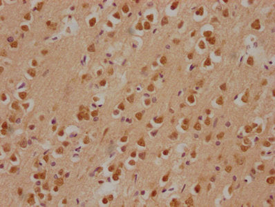 IHC image of PRKACA Antibody diluted at 1:200 and staining in paraffin-embedded human brain tissue performed on a Leica BondTM system. After dewaxing and hydration, antigen retrieval was mediated by high pressure in a citrate buffer (pH 6.0). Section was blocked with 10% normal goat serum 30min at RT. Then primary antibody (1% BSA) was incubated at 4°C overnight. The primary is detected by a biotinylated secondary antibody and visualized using an HRP conjugated SP system.Rabbit anti-Human PRKACA Polyclonal Antibody