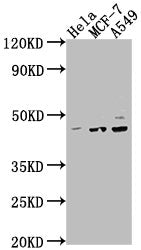 Western Blot | Positive WB detected in: Hela whole cell lysate, MCF-7 whole cell lysate, A549 whole cell lysate | All lanes: PRKACA antibody at 1:2000 | Secondary | Goat polyclonal to rabbit IgG at 1/50000 dilution | Predicted band size: 41, 40 kDa | Observed band size: 41 kDaRabbit anti-Human PRKACA Polyclonal Antibody