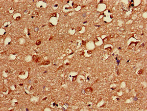Immunohistochemistry of paraffin-embedded human brain tissue using PRKACB Antibody at dilution of 1:100Rabbit anti-Human PRKACB Polyclonal Antibody