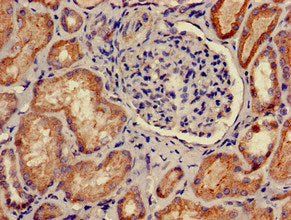 Immunohistochemistry of paraffin-embedded human kidney tissue using PRKACB Antibody at dilution of 1:100Rabbit anti-Human PRKACB Polyclonal Antibody