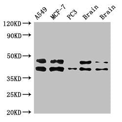 Western Blot | Positive WB detected in: A549 whole cell lysate, MCF-7 whole cell lysate, PC-3 whole cell lysate, Rat brain tissue, Mouse brain tissue | All lanes: PRKACB antibody at 3μg/ml | Secondary | Goat polyclonal to rabbit IgG at 1/50000 dilution | Predicted band size: 41, 47, 40, 42, 30, 37 kDa | Observed band size: 41, 47 kDaRabbit anti-Human PRKACB Polyclonal Antibody
