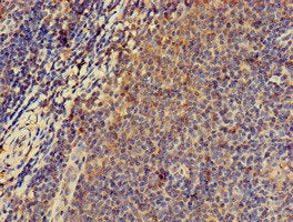 Immunohistochemistry of paraffin-embedded human lymph node tissue using PRKAR2A Antibody at dilution of 1:100Rabbit anti-Human PRKAR2A Polyclonal Antibody