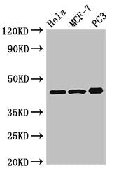 Western Blot  | Positive WB detected in: Hela whole cell lysate, MCF-7 whole cell lysate, PC-3 whole cell lysate  | All lanes: PRKAR2A antibody at 2.5µg/ml  | Secondary  | Goat polyclonal to rabbit IgG at 1/50000 dilution  | Predicted band size: 46, 44 kDa  | Observed band size: 46 kDaRabbit anti-Human PRKAR2A Polyclonal Antibody