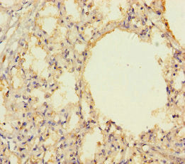 Immunohistochemistry of paraffin-embedded human lung tissue using THAP12 Antibody at dilution of 1:100Rabbit anti-Human THAP12 Polyclonal Antibody